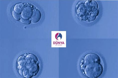 A­v­u­s­t­r­a­l­y­a­l­ı­ ­F­e­r­t­i­l­i­s­,­ ­I­V­F­ ­e­m­b­r­i­y­o­ ­k­ü­l­t­ü­r­ü­n­ü­ ­o­t­o­m­a­t­i­k­l­e­ş­t­i­r­m­e­k­ ­i­ç­i­n­ ­2­ ­m­i­l­y­o­n­ ­d­o­l­a­r­ ­t­o­p­l­a­d­ı­